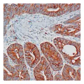 Anti-COX2 antibody [SP21] used in IHC (Paraffin sections) (IHC-P). GTX16701