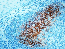 Anti-CD23 antibody [SP23] used in IHC (Paraffin sections) (IHC-P). GTX16702