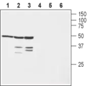 Anti-Kv beta 1 antibody used in Western Blot (WB). GTX16705