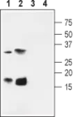 Anti-KCNE4 antibody used in Western Blot (WB). GTX16707