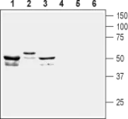 Anti-KCNF1 antibody used in Western Blot (WB). GTX16710