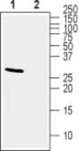 Anti-KChIP2 antibody used in Western Blot (WB). GTX16714