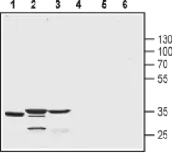 Anti-CSEN antibody used in Western Blot (WB). GTX16715