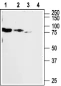 Anti-P2X2 antibody used in Western Blot (WB). GTX16789