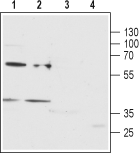 Anti-P2Y12 antibody used in Western Blot (WB). GTX16888