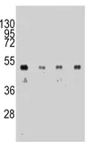 Anti-HA tag antibody [12CA5] used in Western Blot (WB). GTX16918