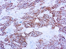 Anti-Her2 / ErbB2 antibody (ready-to-use) used in IHC (Paraffin sections) (IHC-P). GTX16932