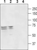Anti-PEX5L antibody used in Western Blot (WB). GTX16934