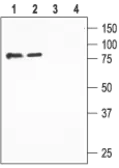 Anti-ENaC Beta antibody used in Western Blot (WB). GTX16967