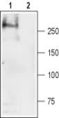 Anti-SCN4A antibody used in Western Blot (WB). GTX16970