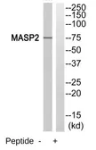Anti-MASP2 antibody used in Western Blot (WB). GTX16975