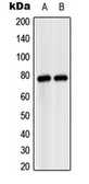 Anti-MASP2 antibody used in Western Blot (WB). GTX16976