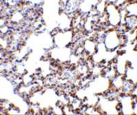 Anti-SnoN antibody used in IHC (Paraffin sections) (IHC-P). GTX16977