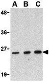 Anti-DEDD2 antibody used in Western Blot (WB). GTX16979