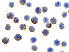 Anti-ATG7 antibody used in Immunocytochemistry/ Immunofluorescence (ICC/IF). GTX16984