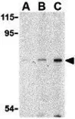 Anti-ATG7 antibody used in Western Blot (WB). GTX16985