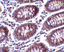 Anti-MICA antibody used in IHC (Paraffin sections) (IHC-P). GTX16991