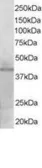 Anti-KLF3 antibody, N-term used in Western Blot (WB). GTX17007