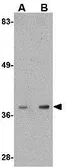 Anti-ALDH3A2 antibody used in Western Blot (WB). GTX17013