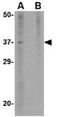 Anti-Akirin 2 antibody used in Western Blot (WB). GTX17014
