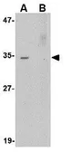 Anti-Akirin 2 antibody used in Western Blot (WB). GTX17015