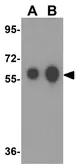 Anti-ALDH5A1 antibody used in Western Blot (WB). GTX17016