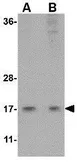 Anti-HINT1 antibody used in Western Blot (WB). GTX17017