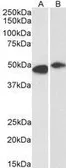 Anti-FBXL2 antibody, N-term used in Western Blot (WB). GTX17018