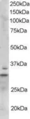Anti-Lime1 antibody, C-term used in Western Blot (WB). GTX17025