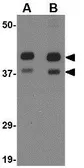 Anti-AIPL1 antibody used in Western Blot (WB). GTX17027