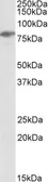 Anti-SLP76 antibody, N-term used in Western Blot (WB). GTX17029