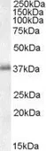 Anti-LAT antibody, C-term used in Western Blot (WB). GTX17032