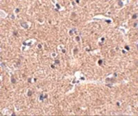 Anti-GALNT10 antibody used in IHC (Paraffin sections) (IHC-P). GTX17043