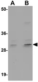 Anti-CENPO antibody used in Western Blot (WB). GTX17045
