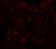 Anti-PLEKHM1 antibody used in IHC (Paraffin sections) (IHC-P). GTX17056