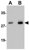 Anti-Synaptogyrin 2 antibody used in Western Blot (WB). GTX17057