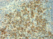 Anti-CD3 zeta antibody used in IHC (Paraffin sections) (IHC-P). GTX17061