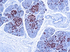Anti-Chromogranin A antibody used in IHC (Paraffin sections) (IHC-P). GTX17064