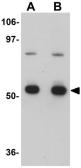 Anti-CDC23 antibody used in Western Blot (WB). GTX17066