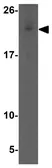 Anti-Apc11 antibody used in Western Blot (WB). GTX17072