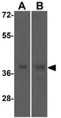 Anti-SIRT4 antibody used in Western Blot (WB). GTX17074