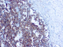 Anti-CD99 antibody [HO36-1.1] used in IHC (Paraffin sections) (IHC-P). GTX17083