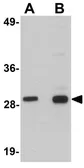 Anti-SIRT6 antibody used in Western Blot (WB). GTX17089
