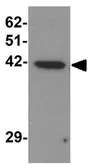 Anti-ZBTB6 antibody used in Western Blot (WB). GTX17096