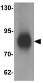 Anti-LRRFIP1 antibody used in Western Blot (WB). GTX17100