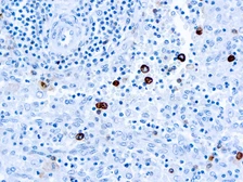 Mouse Anti-Human IgM antibody [R1/69]. GTX17104