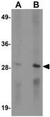 Anti-CD244 antibody used in Western Blot (WB). GTX17115