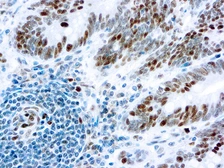 Anti-Rb antibody [1F8] (ready-to-use) used in IHC (Paraffin sections) (IHC-P). GTX17119
