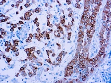 Anti-Cytokeratin 5 antibody [XM26] used in IHC (Paraffin sections) (IHC-P). GTX17130