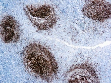 Anti-CD23 antibody [1B12] used in IHC (Paraffin sections) (IHC-P). GTX17142